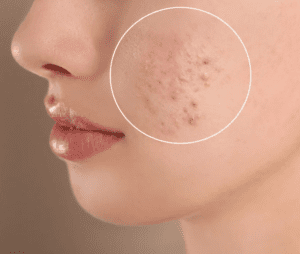 Slika, ki vsebuje besede koža, približati, oseba, vrat Opis je samodejno ustvarjen